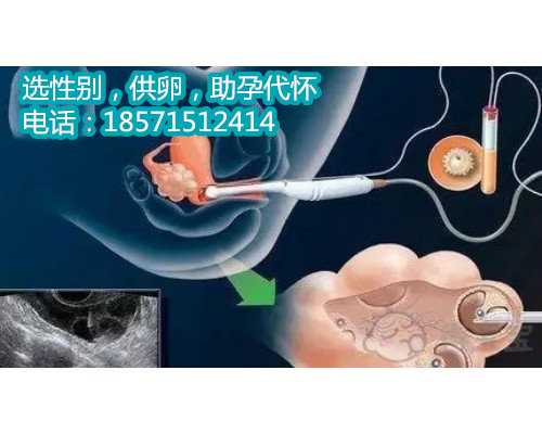 广州代孕专业机