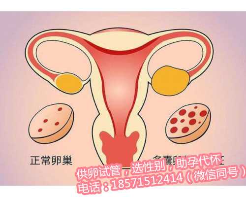 孕妇电磁炉吃火锅会导致广州供卵咨询畸形吗？