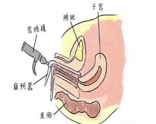 广州助孕公司收费标准对比