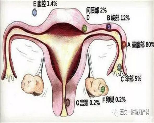 广州代孕哪里有,陪朋友的老婆体检，查出怀孕了