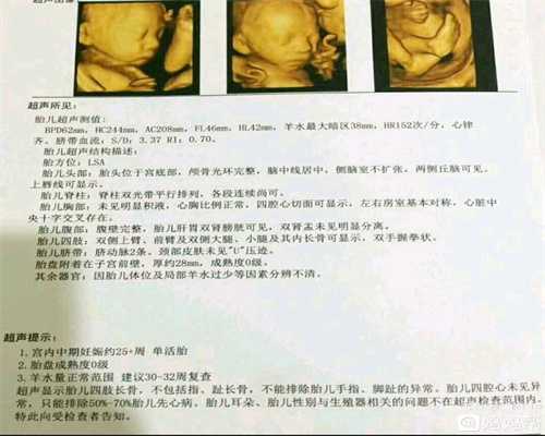 助孕机构广州,一项声称HPV疫苗会影响怀孕的研究