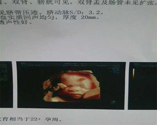 广州哪个医院可以代孕-怀孕4个月可以吃杨桃吗