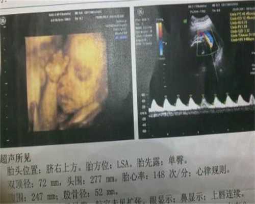 广州传承助孕中心怎样：孕50天早孕反应消失了吗