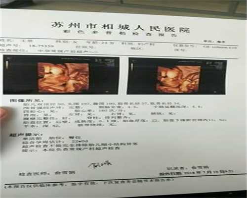 广州代孕包成功多少钱：刚怀孕腰特别酸正常吗
