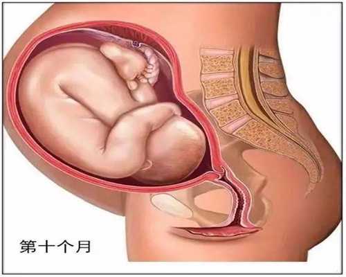 广州代孕包儿子_怀孕70天能做无痛吗
