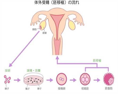 广州代孕公司_胎盘老化和补钙有关吗