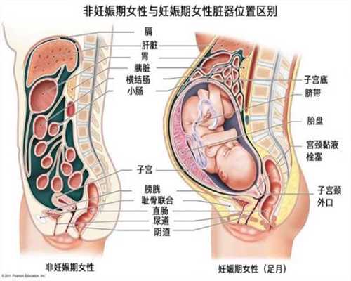 广州代孕免费咨询_吃什么能让子宫内膜厚呢