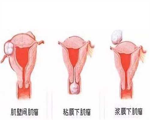广州代怀孕中介_母乳宝宝需要拍嗝吗，要怎么拍才好呢