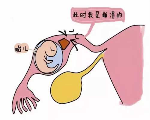广州代孕成都联系方式_孕妇突然尿不停为什么