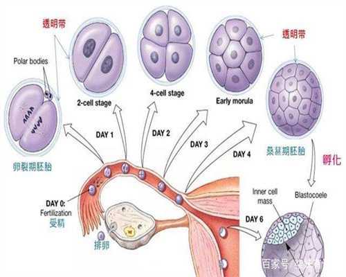 广州代孕产子价格生子_脑膜炎期内常并发脑脓肿