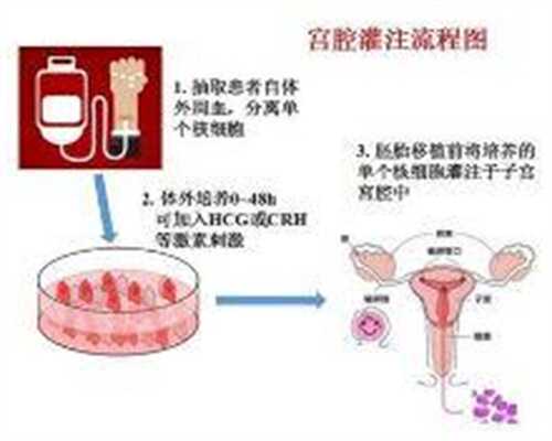 广州最详细代孕产子价格多少钱_怀孕b超是什么样的