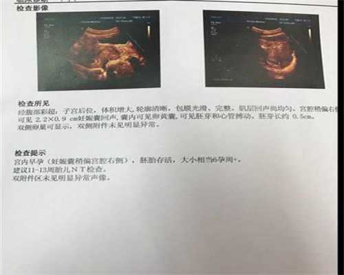 广州助孕机构_怀孕每天玩手机有影响吗
