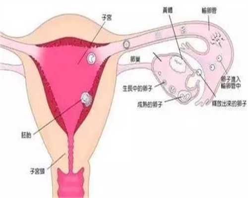 广州代孕风险,广州专业代怀孕,什么是边缘性前置胎盘