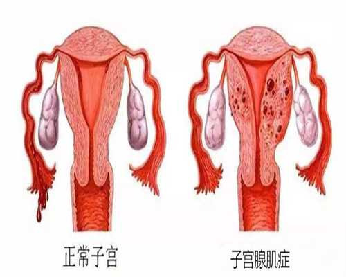 广州代孕成功率,广州代孕成功率,广州如何成为代孕妈妈