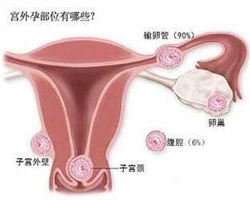 广州代孕最高年