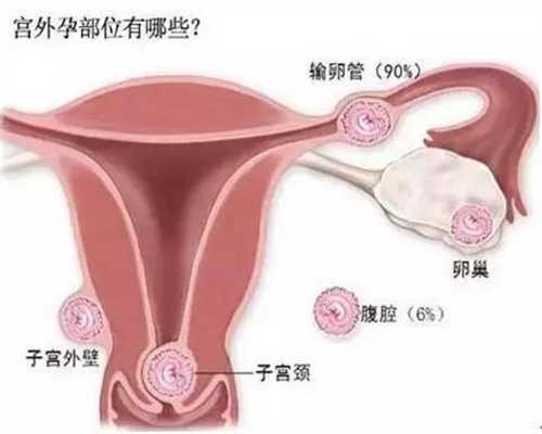 广州助孕,广州代孕合法了没,广州代孕生子能成功吗