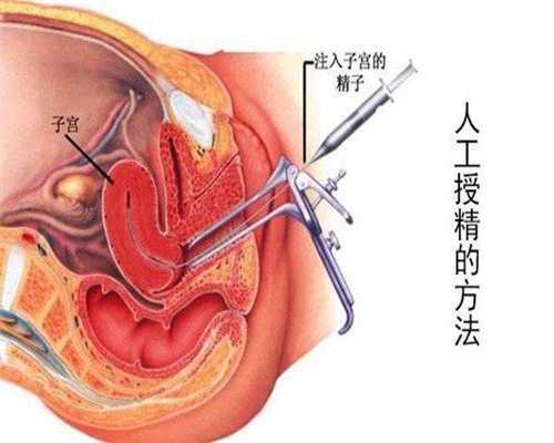 广州2020医院代孕_济南代孕有什么要求_济南找一个代生孩子的