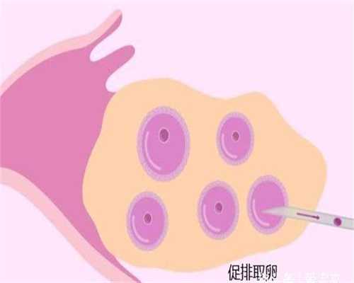 广州代孕包男孩_代孕孩子2020联系电话_代孕男孩一键咨询