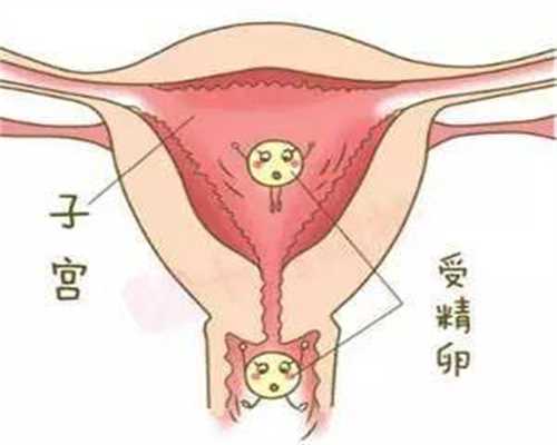 广州代孕微信_代孕儿子电话_专业代孕小孩电话