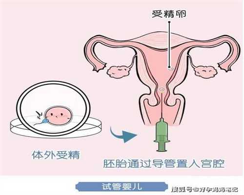 广州代孕公司对比_代孕宝宝电话_国外代孕小孩子
