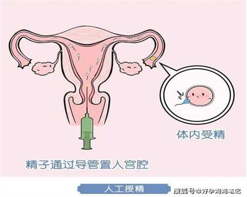 广州代孕产子_代孕宝宝保密咨询_代孕一个孩子要多少钱啊