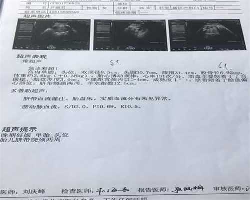 世纪代孕总部-广州哪里找代孕_最新2019试管婴儿技术排名[详解篇]