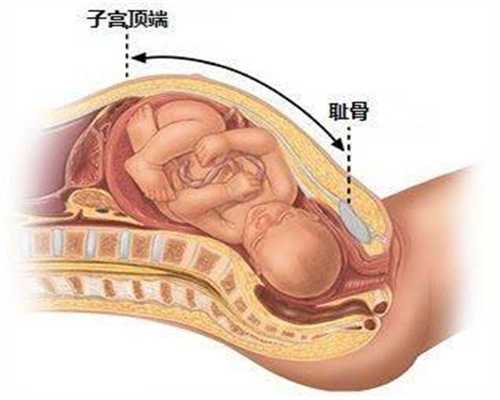找代孕得多少钱-广州有供卵的生殖中心_北京什么医院人工授精较好？