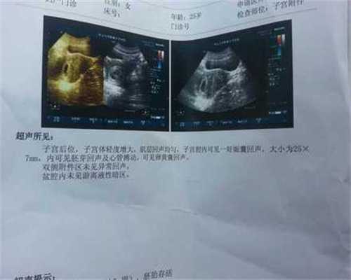 广州代孕找什么人合适-单身男代孕_月经期可以打新冠疫苗吗？关于新冠疫苗，