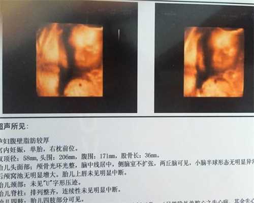 广州三代试管供卵助孕费用-代孕选男女费用_据说做试管婴儿只能活40岁是真的