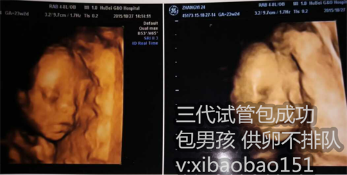 广州试管婴儿捐卵供卵，敢于承认第三方助孕的明星，娱乐圈还有谁？