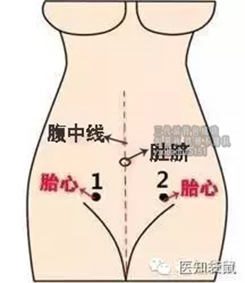 广州生殖医院排名榜，「提醒」男子腹痛就医，竟抽出“牛奶血”！这种病死亡